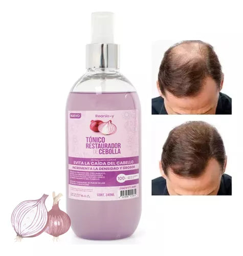 Tonico Capilar De Cebolla Anticaida y Crecimiento